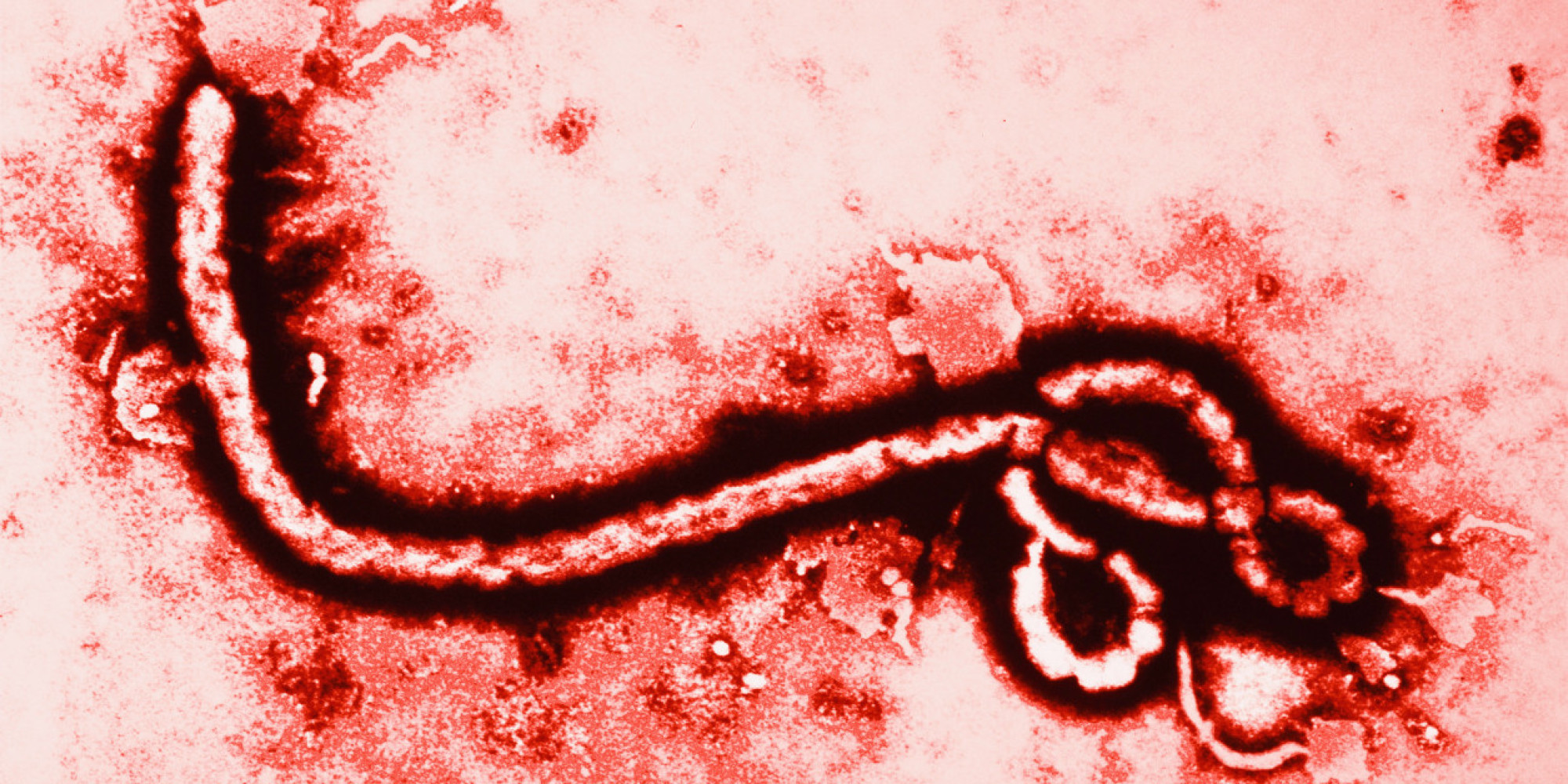 Shep Smith’s rejoinder to “irresponsible” Ebola coverage